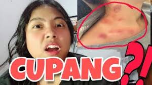 Basuh udang hingga bersih, kemudian gaulkan udang dengan… Ada Tanda Love Bite Eh Diklaim Hasil Kerokan Video Klip Mp4 Mp3