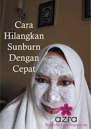 Sunburn ialah penembusan cahaya uv ke dalam lapisan kulit yang akan menyebabkan penghasilan melanin yang lebih perlu berjumpa doktor untuk mendapatkan nasihat. Beauty By Azra Cara Hilangkan Sunburn Dengan Cepat Yang Paling Berkesan