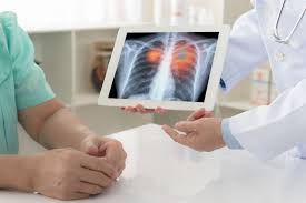 According to the american cancer society, approximately 235,760 new cases of lung cancer will be diagnosed in the u.s. Lung Cancer Screening Signs Symptoms Lung Cancer Causes Cleveland Clinic Abu Dhabi