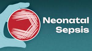 Image result for Neonatal Sepsis