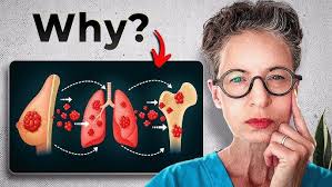 Beyond Breast Cancer: Free program helps survivors with empowerment