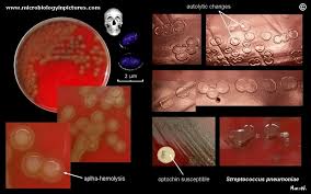 Image result for Penicillin Resistant Pneumococcus
