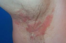 koltuk alti kasinmasi kasinti nedenleri