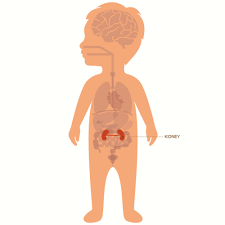 Kidney Tumors In Children And Teens Together They are considered retroperitoneal, which means that they lie behind the. kidney tumors in children and teens