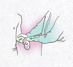 Image result for Yergason Test