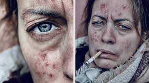 SFX3Prothèses Transferts