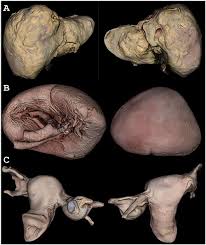 Liver 3d models ready to view, buy, and download for free. Anterior And Posterior Views Of Single Organ Specimen 3d Models A Download Scientific Diagram