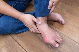 Tanda utama osteoartritis ialah mengalami kesakitan atau sengit di bahagian sendi dalam tempoh yang panjang.… Rematik Dan 5 Penyakit Lain Dengan Gejala Mirip Asam Urat Halaman All Kompas Com