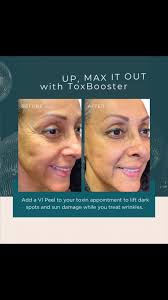 To see:, Me:, 👩🏼‍⚕️Holly Fahey BSN, RN, CANS @nurse_holly_skinesteem,  👩🏼‍⚕️Dawn Naylor NP-BC, DNP, CANS, @skinesteemmedspa, 👩🏼‍⚕️Lindsay  Murphy, BSN, MSN, FNP-C, CANS , @lindsaynp_skinesteem, ...