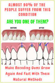 Pin On Beauty Tips
