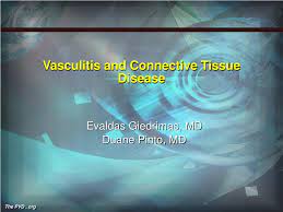 Ppt Vasculitis And Connective Tissue Disease Powerpoint Presentation Id 1183241