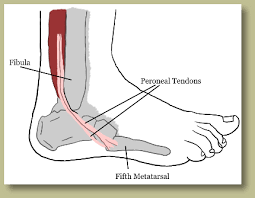 The tranverse metatarsal arch spans the width of the foot and is supported by a variety of muscles, ligaments and tendons, including the interossei, adductor. Peroneal Ankle Tendon Injuries In Pueblo Pueblo West Co Pueblo Ankle And Foot Care Pllc