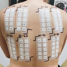 Image result for Patch Testing