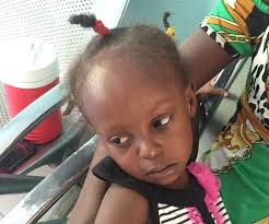 Haiti Nov 2015 Surgical Mission