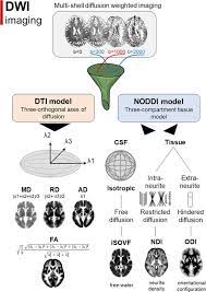 Neurite Orientation Dispersion and Density Imaging in Multiple Sclerosis: A  Systematic Review - Seyedmirzaei - 2023 - Journal of Magnetic Resonance  Imaging - Wiley Online Library