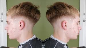 Albino TAKUACHE!?! *WHITE EDGAR*