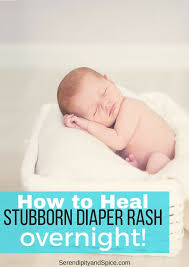 How To Heal Diaper Rash In Toddlers Diaper Rash Baby Diaper Rash Teething Diaper Rash