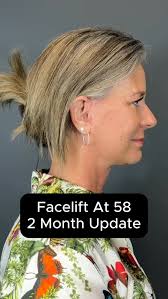 Tansavatdi Facial...