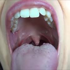 Keep Calm And Love Keep Calm And Love Fillings And Mouth