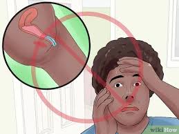 Sie suchen den besten sale? How To Use The Nuvaring 13 Steps With Pictures Wikihow