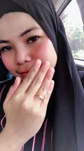Tangan Busuk Sampai Isi Kulit Saya Nampak Derita Ekzema Gadis Ini Berakhir Setelah Dapatkan Rawatan