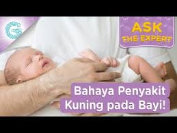Penyakit kuning atau jaundis bayi adalah gejala yang biasa berlaku dalam kalangan bayi kesan daripada kerosakan sel darah merah yang lama. Apa Penyebab Penyakit Kuning Pada Orang Dewasa