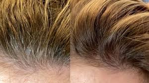So blue that i was almost nervous for a moment. Gray Hair Root Touch Up In Just 10 Minutes Schwarzkopf Igora Color10 Tutorial Daniella Benita Youtube
