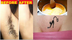 How do i know which method is best? In 5 Minutes Remove Unwanted Hair Naturally And Permanently Unwanted Hair Will Never Grow Back Youtube