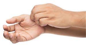 Ivermectin ist seit 2016 der erste wirkstoff zur oralen behandlung der krätze. Mittel Gegen Kratze Richtig Anwenden Resistenz Vermeiden Pz Pharmazeutische Zeitung