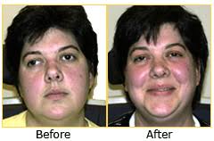 Giving Heather New Confidence