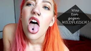 Was Tun Gegen Wildfleisch Bei Piercings Schnurstracks Youtube