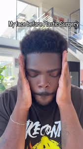 Amazing Plastic Surgery Procedure by Skilled Doctor