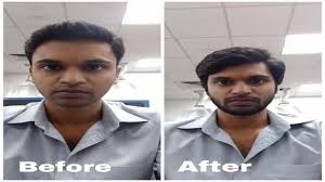 Is it No-Shave Quarantine?