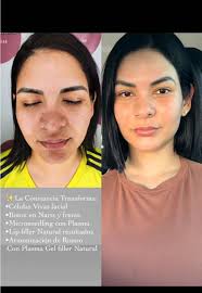 EstéticaUniqueFacialCovarrubia (@uniquefacialcovarrubias)