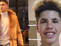 Marquese chriss also signed with pelinka. Kyle Kuzma Hilarious Response To Young Lamelo Ball I M So Fly I Could Fly Between That Gap Between Yo Teeth Fadeaway World