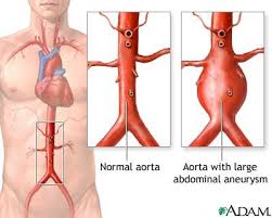 V the abdomen consists of: Abdominal Mass Information Mount Sinai New York