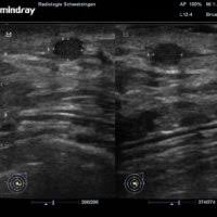 Mammographie Radiologie Rhein Neckar De