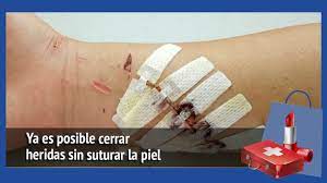 Ya Es Posible Cerrar Heridas Sin Suturar La Piel Youtube