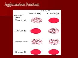 18 Blood Typing Blood Types Agglutination Chart