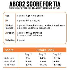 Image result for ABCD2 Score