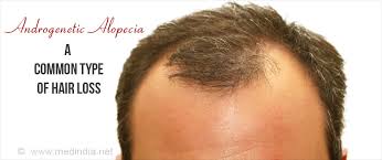 A number of studies have shown that increasing pge2 levels on the scalp can benefit hair growth. Top 5 Tips For Faster Hair Growth Beauty Tips