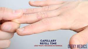 It is used to monitor dehydration and the amount of blood flow to tissue. Hydration Status Assessment Osce Guide Geeky Medics