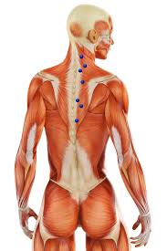 Myofascial Pain Syndrome Uncovering The Root Causes