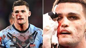 Royston lightning, robert campbell, andy marinos, tiaan strauss. State Of Origin Nathan Cleary Spurts Blood As Nsw Blues Halfback Avoids Medical Attention Verve Times