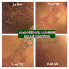 Untuk rekor dunia yang pernah tercatat adalah kakap merah dengan berat 25 kg atau 50 pon. Beza Antara Kayap Dan Kurap