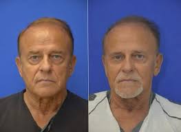 Dr. Jonathan Berman, MD, FACS