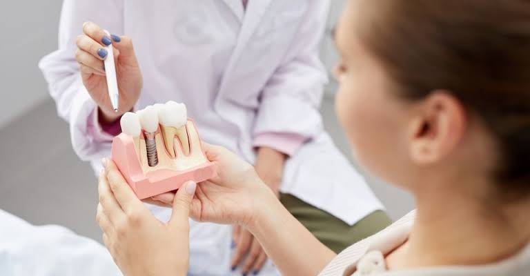 Dental Implants Vs. Dentures: Choosing What's Right For You | Engel Dental  Center