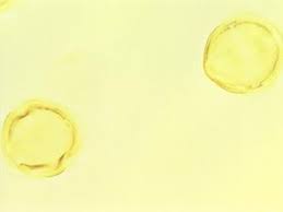 Image result for Ixora brachypoda