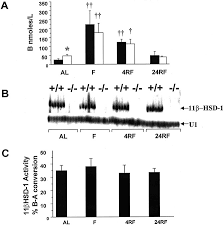 Improved Lipid And Lipoprotein Profile Hepatic Insulin Sensitivity And Glucose Tolerance In 11b Hydroxysteroid Dehydrogenase Type 1 Null Mice Sciencedirect