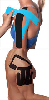 Pin On Kinesiology Tape Shoulder